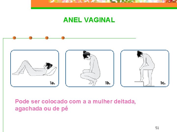 ANEL VAGINAL Pode ser colocado com a a mulher deitada, agachada ou de pé