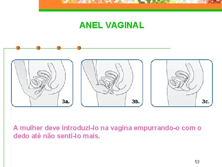 ANEL VAGINAL A mulher deve introduzi-lo na vagina empurrando-o com o dedo até não