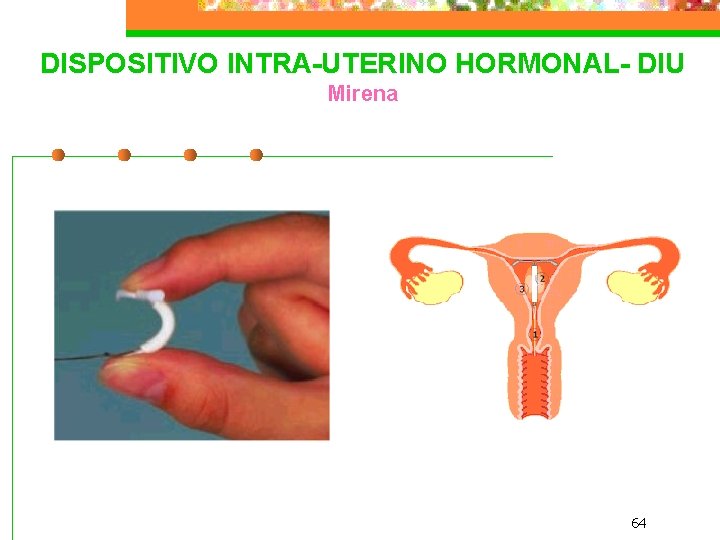 DISPOSITIVO INTRA-UTERINO HORMONAL- DIU Mirena 64 