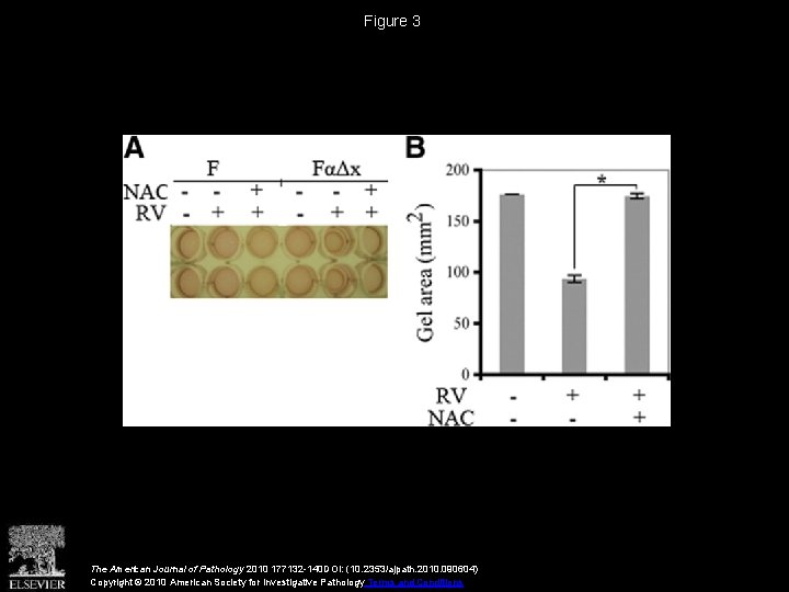 Figure 3 The American Journal of Pathology 2010 177132 -140 DOI: (10. 2353/ajpath. 2010.