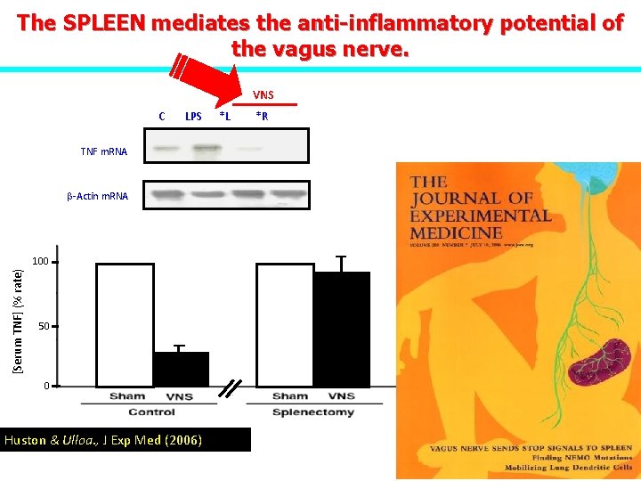The SPLEEN mediates the anti-inflammatory potential of the vagus nerve. VNS C LPS TNF