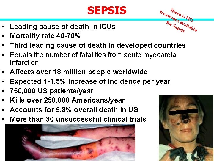 SEPSIS • • • tre There atm ent is NO a for Sep vailab