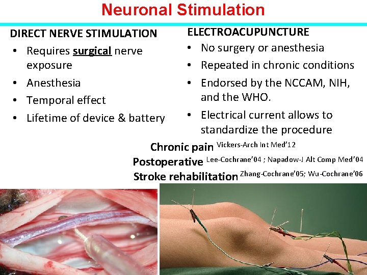 Neuronal Stimulation ELECTROACUPUNCTURE • No surgery or anesthesia • Repeated in chronic conditions •