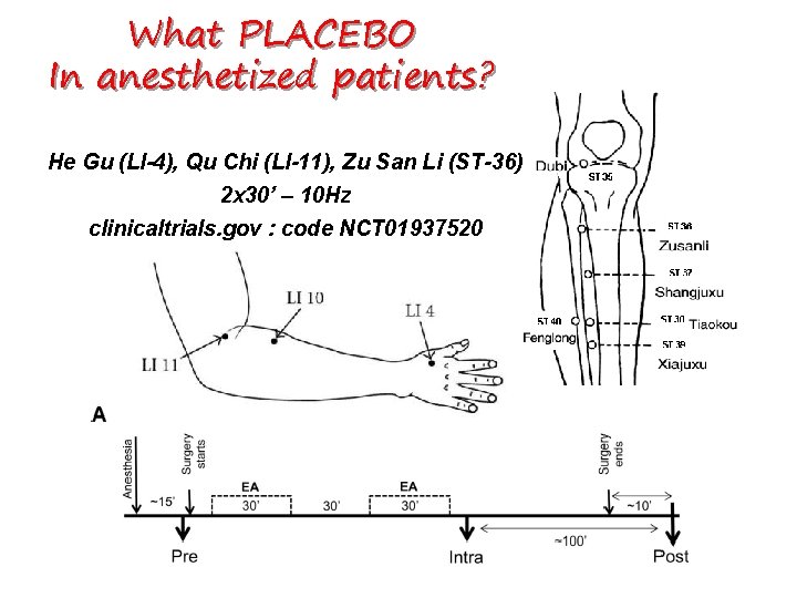 What PLACEBO In anesthetized patients? He Gu (LI-4), Qu Chi (LI-11), Zu San Li