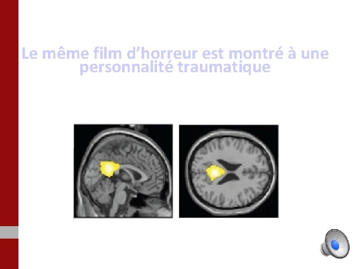 Le même film d’horreur est montré à une personnalité traumatique 