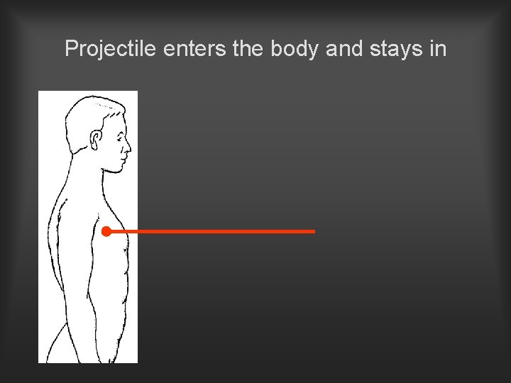 Projectile enters the body and stays in 