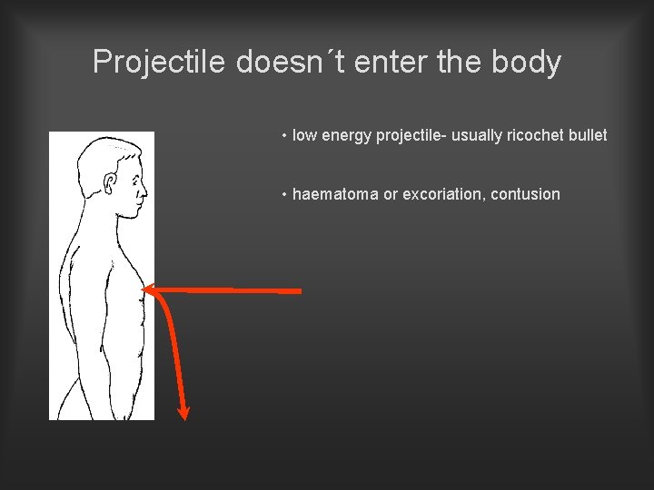 Projectile doesn´t enter the body • low energy projectile- usually ricochet bullet • haematoma
