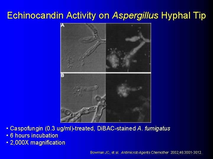 Echinocandin Activity on Aspergillus Hyphal Tip • Caspofungin (0. 3 ug/ml)-treated, Di. BAC-stained A.