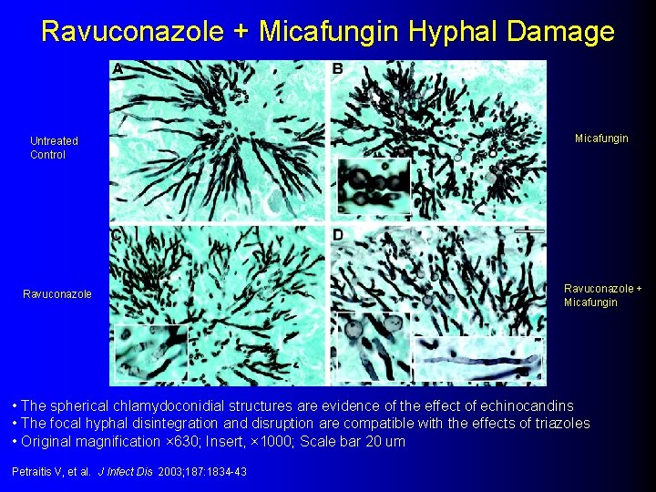 Ravuconazole + Micafungin Hyphal Damage Untreated Control Ravuconazole Micafungin Ravuconazole + Micafungin • The