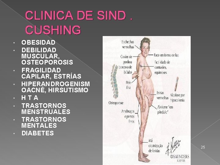 CLINICA DE SIND. CUSHING • • OBESIDAD DEBILIDAD MUSCULAR, OSTEOPOROSIS FRAGILIDAD CAPILAR, ESTRÍAS HIPERANDROGENISM