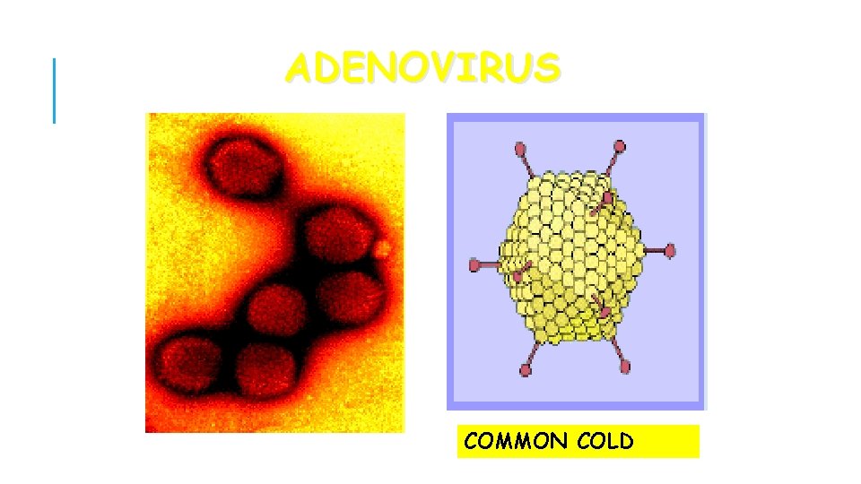 ADENOVIRUS COMMON COLD COPYRIGHT CMASSENGALE 28 