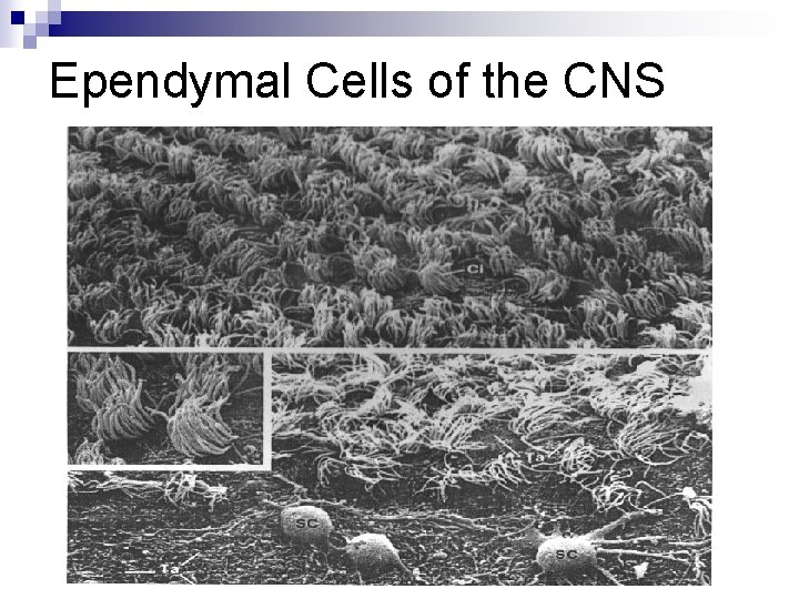 Ependymal Cells of the CNS 