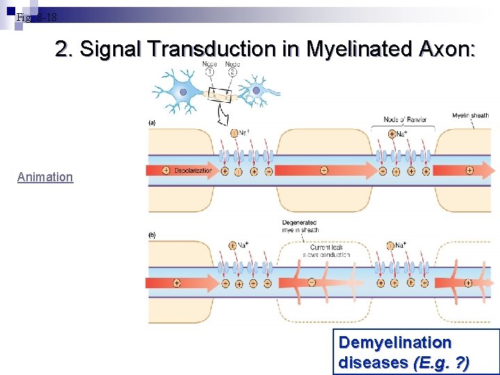 Fig. 8 -18 2. Signal Transduction in Myelinated Axon: Animation Demyelination diseases (E. g.