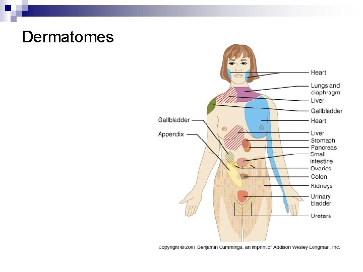 Dermatomes 