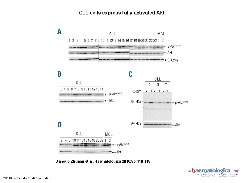 CLL cells express fully activated Akt. Jianguo Zhuang et al. Haematologica 2010; 95: 110