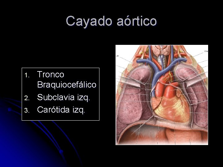 Cayado aórtico 1. 2. 3. Tronco Braquiocefálico Subclavia izq. Carótida izq. 