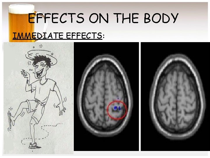 EFFECTS ON THE BODY IMMEDIATE EFFECTS: 