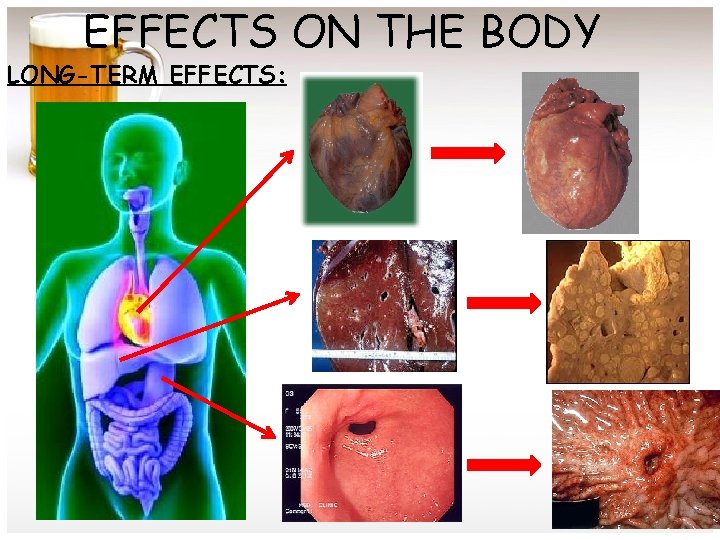 EFFECTS ON THE BODY LONG-TERM EFFECTS: 