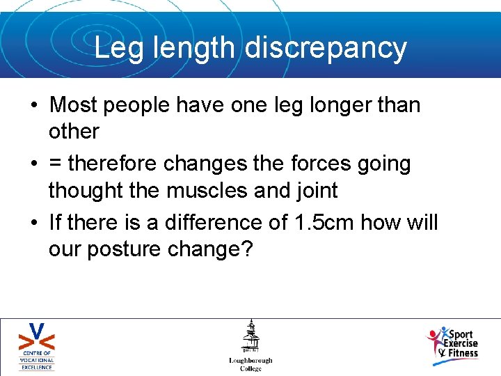 Leg length discrepancy • Most people have one leg longer than other • =