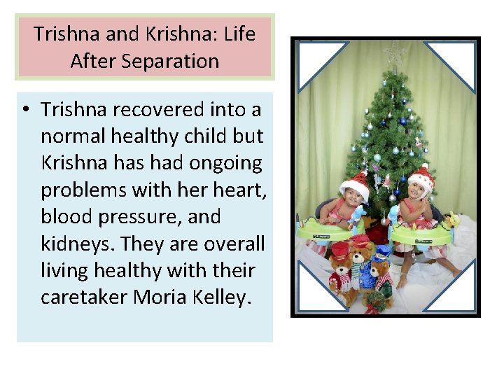 Trishna and Krishna: Life After Separation • Trishna recovered into a normal healthy child