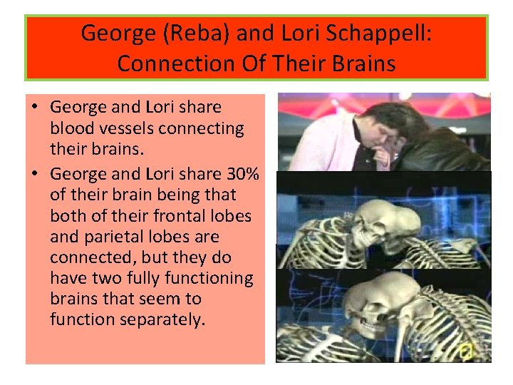 George (Reba) and Lori Schappell: Connection Of Their Brains • George and Lori share