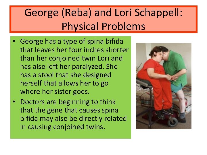 George (Reba) and Lori Schappell: Physical Problems • George has a type of spina