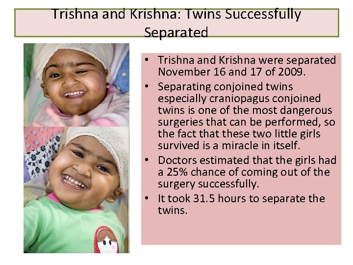 Trishna and Krishna: Twins Successfully Separated • Trishna and Krishna were separated November 16