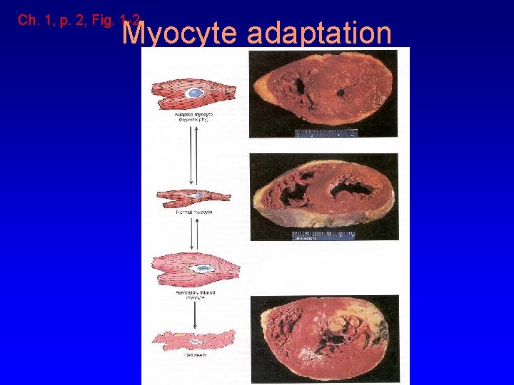 Ch. 1, p. 2, Fig. 1 -2 Myocyte adaptation 