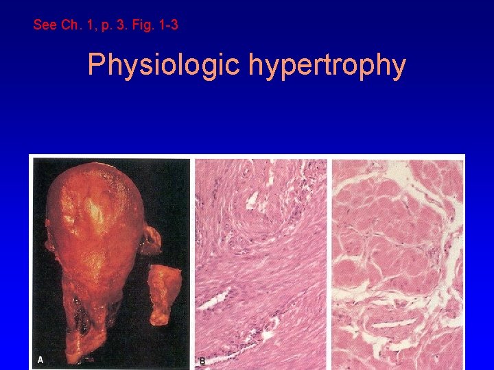 See Ch. 1, p. 3. Fig. 1 -3 Physiologic hypertrophy 