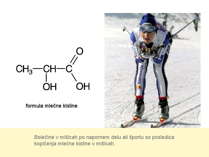 formula mlečne kisline Bolečine v mišicah po napornem delu ali športu so posledica kopičenja