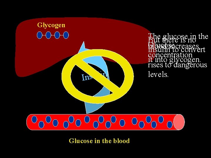 Glycogen Insulin Glucose in the blood The glucose in the But there is no