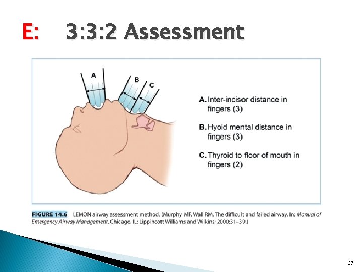 E: 3: 3: 2 Assessment 27 