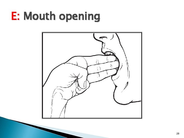 E: Mouth opening 28 