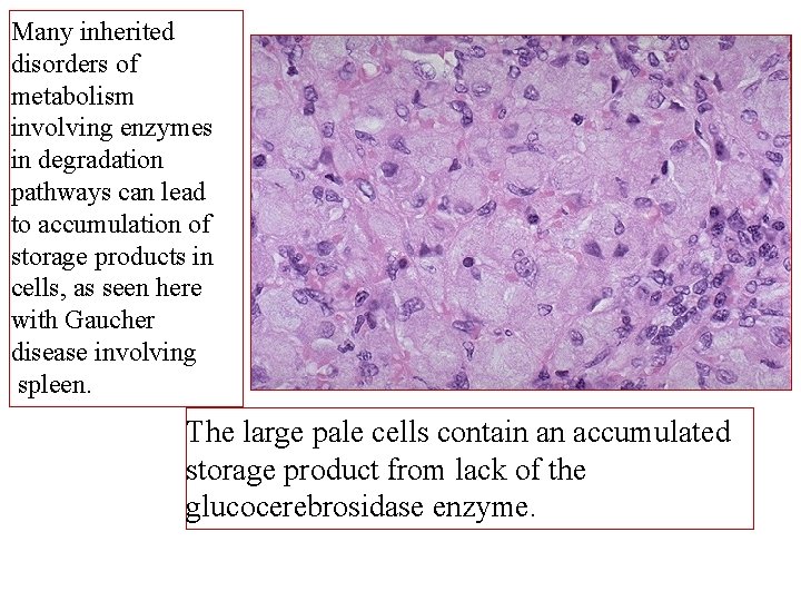 Many inherited disorders of metabolism involving enzymes in degradation pathways can lead to accumulation