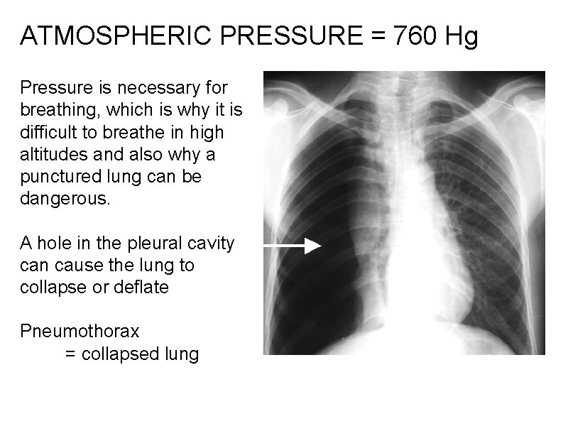 ATMOSPHERIC PRESSURE = 760 Hg Pressure is necessary for breathing, which is why it