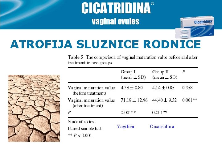 ATROFIJA SLUZNICE RODNICE Vagifem Cicatridina 