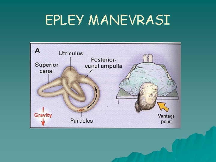 EPLEY MANEVRASI 