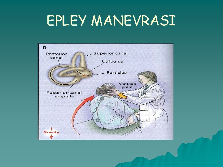 EPLEY MANEVRASI 