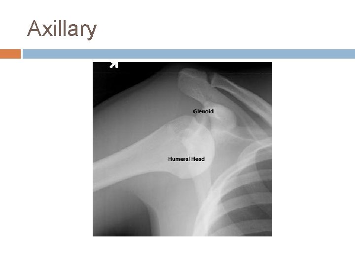 Axillary 