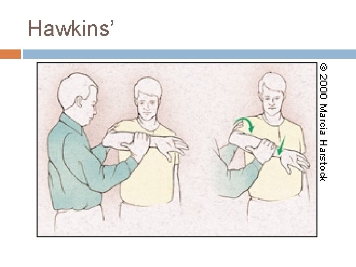 Hawkins’ 