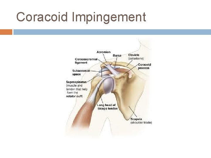 Coracoid Impingement 