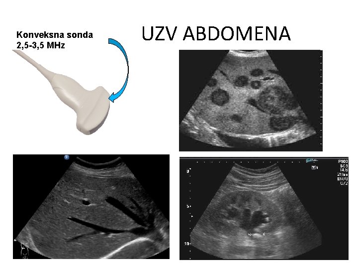 Konveksna sonda 2, 5 -3, 5 MHz UZV ABDOMENA 