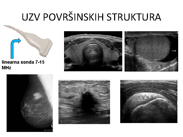 UZV POVRŠINSKIH STRUKTURA linearna sonda 7 -15 MHz 