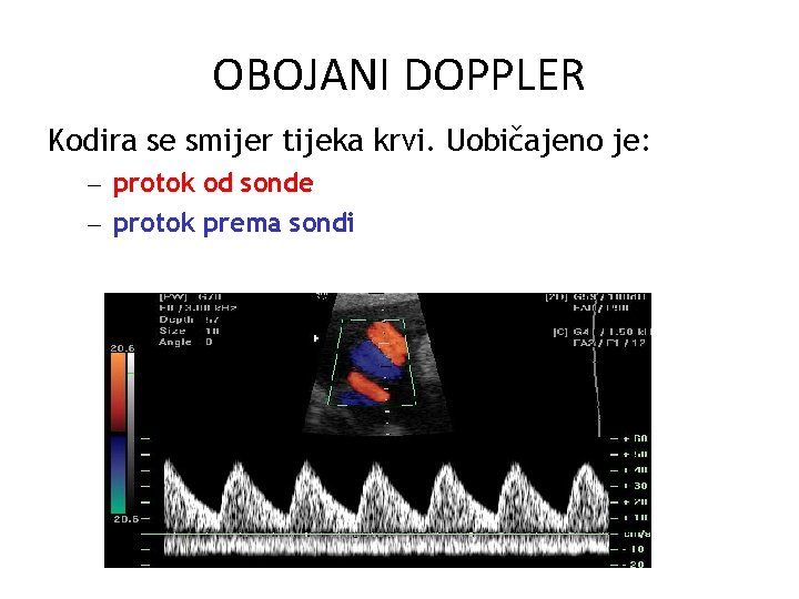 OBOJANI DOPPLER Kodira se smijer tijeka krvi. Uobičajeno je: – protok od sonde –