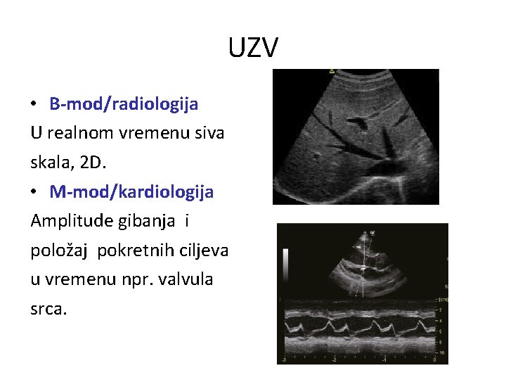 UZV • B-mod/radiologija U realnom vremenu siva skala, 2 D. • M-mod/kardiologija Amplitude gibanja