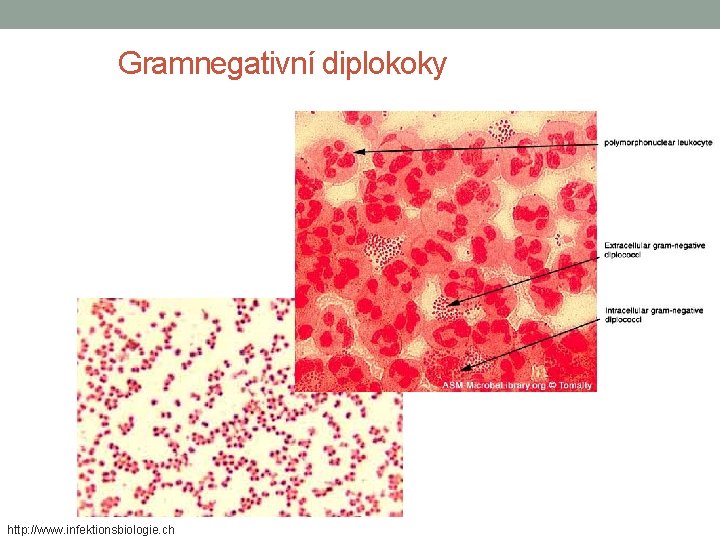 Gramnegativní diplokoky http: //www. infektionsbiologie. ch 