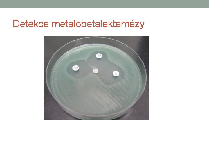 Detekce metalobetalaktamázy 