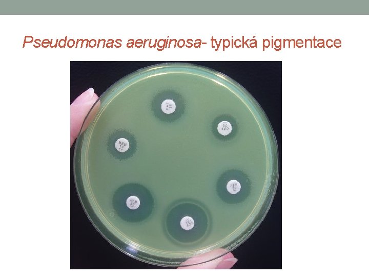 Pseudomonas aeruginosa- typická pigmentace 