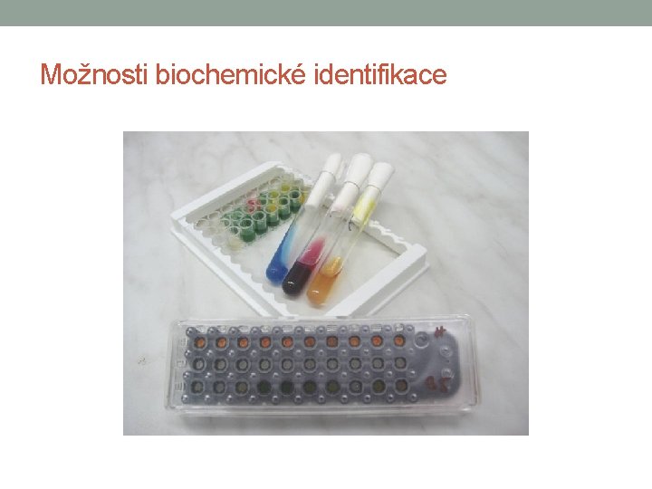 Možnosti biochemické identifikace 