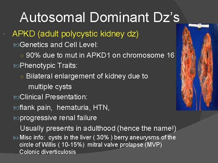 Autosomal Dominant Dz’s APKD (adult polycystic kidney dz) Genetics and Cell Level: ○ 90%